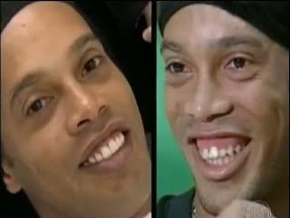 Ronaldinho dan Gigi Barunya