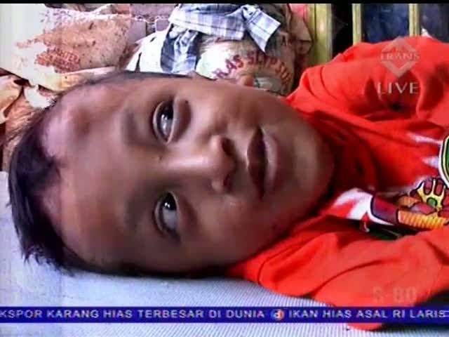 Gizi Buruk, Uki Bercita-cita Jadi Kyai