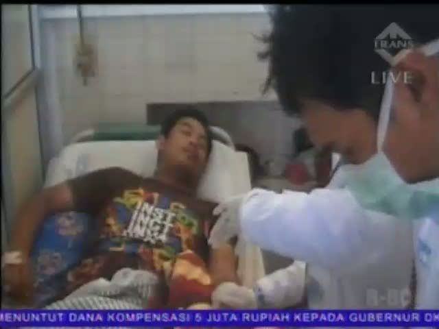 Korban Miras Oplosan Alami Gangguan Penglihatan