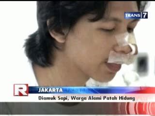 Diamuk Sapi, Warga Alami Patah Hidung