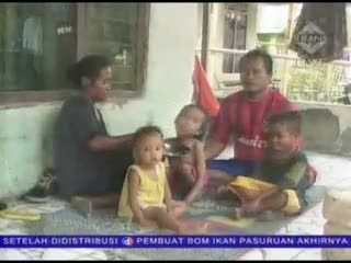 Pendapatan Daerah Tinggi Tapi Gizi Buruk Juga Tinggi