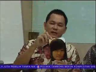 Sudah 2 Bulan Korban Penyiraman Air Keras Dirawat di Ruang Isolasi