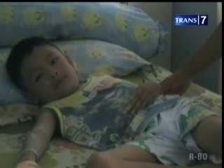 Pasca Berobat, Penyakit Bocah Makin Parah