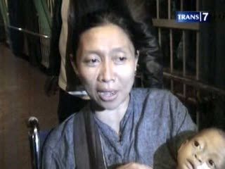 Bayi Berpenyakit Langka Akhirnya Ditangani