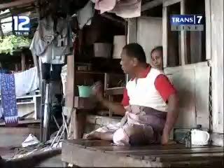Korban Patah Kaki Terancam Pengangguran