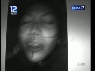 Sales Obat Dianiaya Oknum TNI