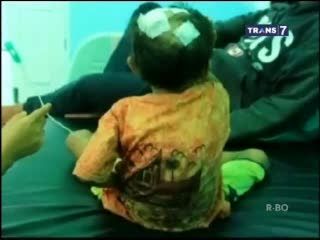 Bocah 6 tahun Ditemukan Penuh Luka