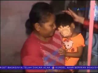 Mata Balita Luka Dipatuk Ayam