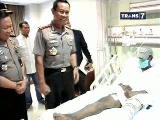 Kapolri Jenguk Anggota Densus yang Tertembak