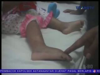 Kesal Karena Sering Menangis, Balita Dianiaya Ayah Tiri