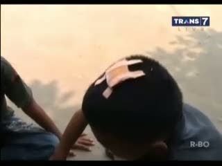 10 Anak Bocor Kepala, Dipukuli Oknum Guru