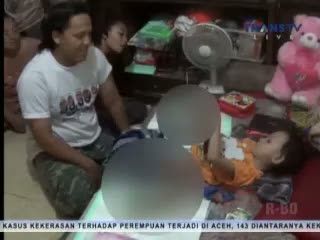 Bocah 4 Tahun Alami Penyakit Aneh, Kaki Membusuk hingga Paha
