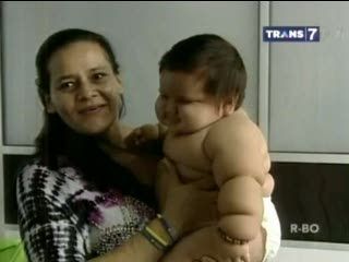 Bayi Super Montok Ini Terancam Obesitas