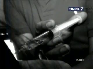 Suntik Kolagen Ilegal