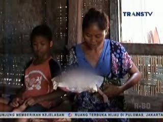 Kurangnya Biaya Membuat Bayi Cacat Ini Tidak Mendapat Penanganan yang Tepat