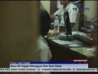 Tak Buat PR, Murid SD Digigit Hidungnya oleh Guru