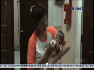 Bayi 2 Bulan Diduga Disiksa Pamannya Hingga Patah Kaki