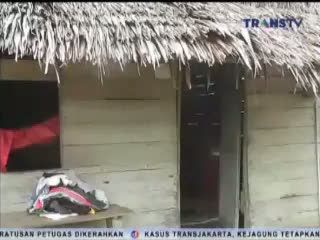 Kondisi Korban Akibat Gigitan Anjing Liar Mulai Membaik