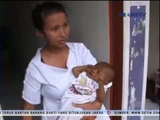 Menderita Penyumbatan Empedu, Bayi Pramudita Harus Jalani Cangkok Hati