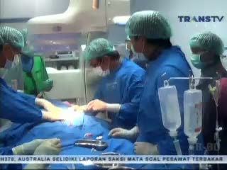 Operasi Katerisasi Jantung Kembar Siam