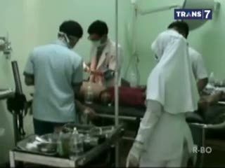 Nekat Bawa Motor, Siswa SD Tabrak Tembok