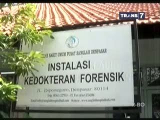 Potongan Kepala Tanpa Mata, Hidung dan Telinga Berjenis Kelamin Wanita