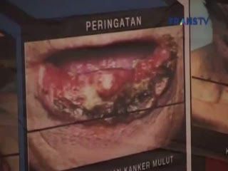 Gambar Seram di Kemasan Rokok, Efektifkah?