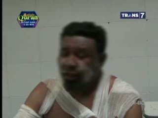 Yusri: Muka Saya Disiram Bensin, Terus Dibakar