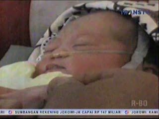 Dikubur di Ladang, Bayi Perempuan Masih Hidup Saat Ditemukan