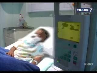 Operasi Plastik dengan Teknik Skin Graft