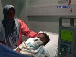 Begini Kondisi Bocah yang Disiram Air Keras Ayah Tiri Pasca Operasi
