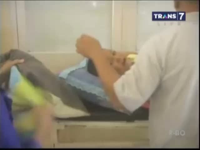 Bermain Bola Api Kaki Kanan Melepuh