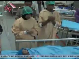Bayi Kembar Siam Asal Banyuwangi Jalani Operasi Pemisahan