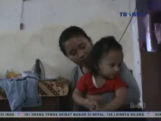 Diduga Malpraktik, Bayi Cantik Ini Alami Kebutaan Permanen