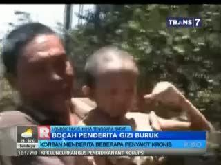 Balita Penderita Beberapa Penyakit Kronis Kerap Meronta Memukuli Kepalanya