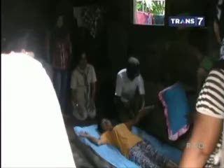 Disiksa Majikan di Malaysia, TKW Indonesia Alami Cacat
