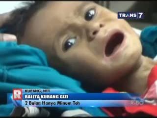 Bayi 10 Bulan Sekarat karena 2 Bulan Hanya Minum Air Teh