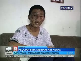Pelajar SMK Disiram Air Keras
