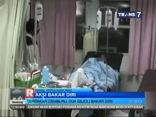 Akibat Cemburu, Dua Sejoli Bakar Diri dalam Kondisi Berdekapan 