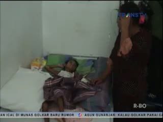 Gizi Buruk, Anak 12 Tahun Berbobot 15 Kg