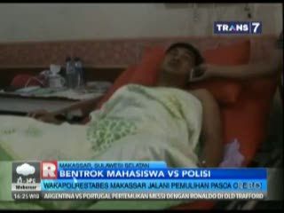 Wakapolrestabes Makassar Jalani Pemulihan Pasca Operasi
