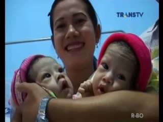  Bayi Kembar Syahrina-Syahrini Dipindah ke Ruang Perawatan Biasa