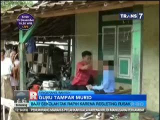 Resleting Celana Tak Ditutup karena Rusak, Murid Dianiaya Guru