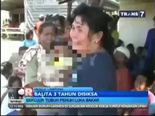Balita 3 Tahun Menjadi Korban Penganiayaan