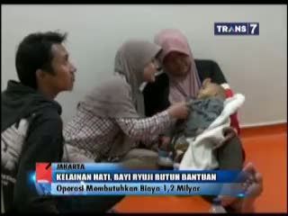 Kelainan Hati, Bayi Ryuji Butuh Biaya Pengobatan Hingga 1,2 Miliar