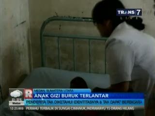 Penderita Gizi Buruk Terlantar di Jalan