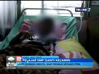 Pelajar SMP Ganti Kelamin Jalani Operasi Tahap Dua