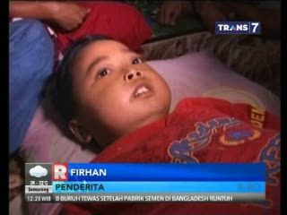 Alat Vital Bengkak, Seorang Anak kini Hanya Bisa Terbaring