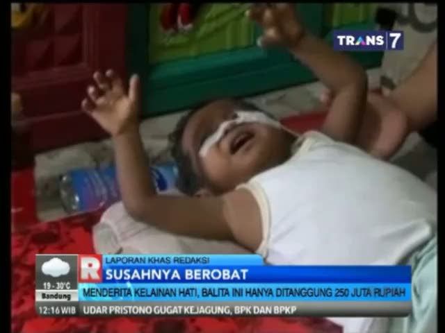 Menderita Kelainan Hati, Balita Ini Hanya Ditanggung Rp 250 Juta