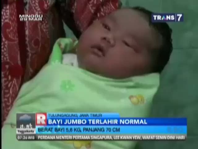 Bayi Jumbo dengan Berat 5,6 Kg dan Panjang 70 Cm Terlahir Normal